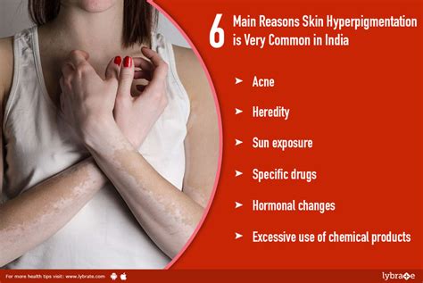 6 Main Reasons Skin Hyperpigmentation Is Very Common In India By Dr