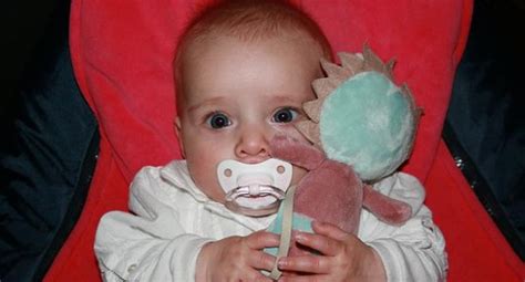 Jul 23, 2020 · infantile, conseguente alla temporanea colonizzazione dell'intestino dei lattanti sotto l'anno di vita da colonizzazione intestinale dell'adulto, si verifica con le stesse modalità del botulismo infantile e colpisce la popolazione di età superiore a un anno che presenta una grave forma di dismicrobismo intestinale Botulisme: surtout pas de miel pour les tout-petits - Enviro2B
