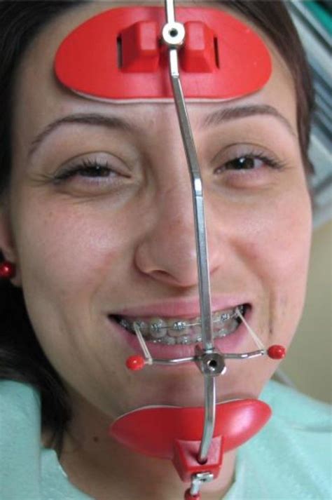 braces braceface metalbraces girlswithbraces headgear facemask teeth braces dental
