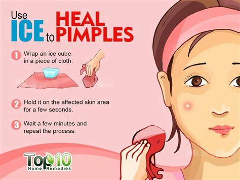 22 Home Remedies For Acne And Pesky Pimples How To Remove Pimples How