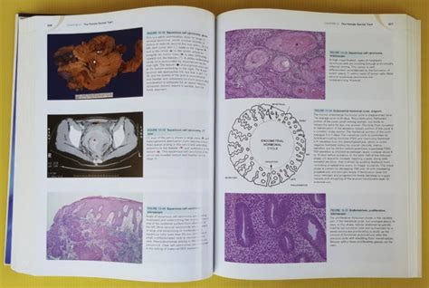 Robbins And Cotran Atlas Of Pathology