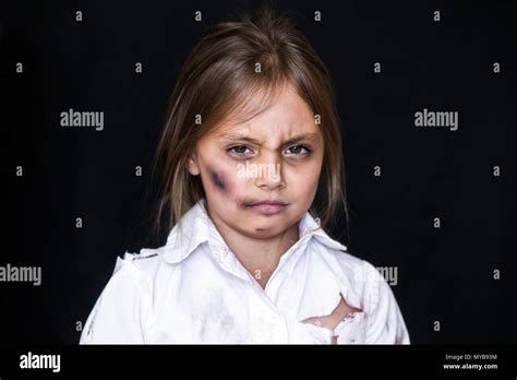 Child Abuse Sad And Lonely Girl Crying Injured Child Posing As