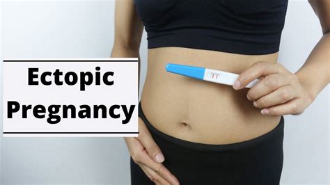 Ectopic Pregnancy Causes Symptoms And Treatment Youtube