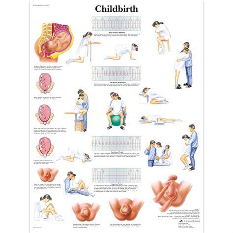 Childbirth Chart 1001574 Vr1555l Pregnancy And