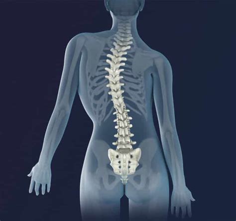 The Differences Between Kyphosis And Scoliosis Custom Rehab Pt