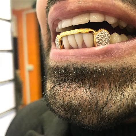 2 Iced Out Canines Gold Bar £1 30000 Gold Teeth Diamond Grillz