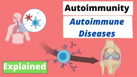 Autoimmunity Immunology Autoimmune Disease And Immune Tolerance