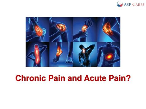 Ppt What Is The Difference Between Chronic Pain And Acute Pain