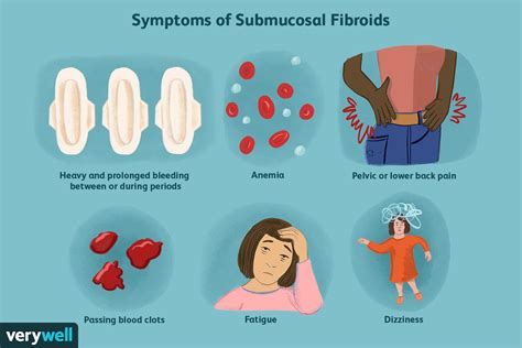 Submucosal Fibroid Overview And More