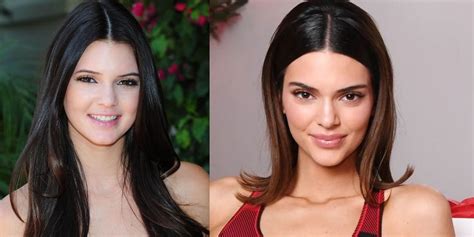 Keeping Up With The Kardashians Kendall Jenner Plastic Surgery Facts