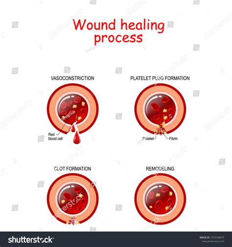 Phases Wound Healing Process Cross Section Vector De Stock Libre De