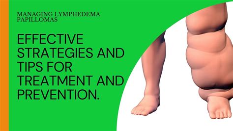 Lymphedema Papillomas Effective Strategies And Tips