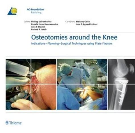 Lobenhoffer Aavv Osteotomies Around The Knee Indication Planning