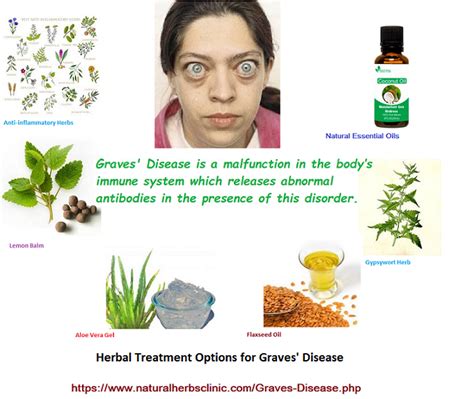 Graves Disease Natural Treatment Natural Herbs Clinic