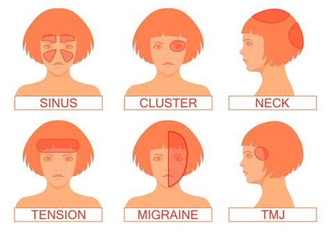 Pin By Liz Butler On Migraine Relief In 2020 Headache Types Headache