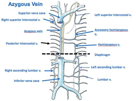 Image Result For Ascending Lumbar Vein Veins Anatomy Class Post