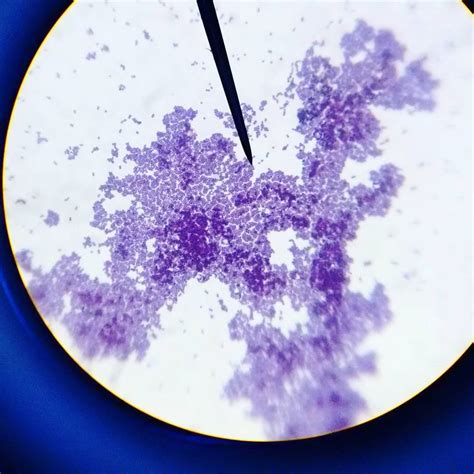 Annals of microbiology and infectious diseases v1● i2 ● 2018. 15 best images about PinBio_1003.2016 O on Pinterest ...