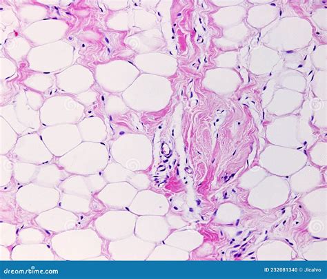 Adipose Tissue Under Microscope View Show Contains Large Lipid Droplet