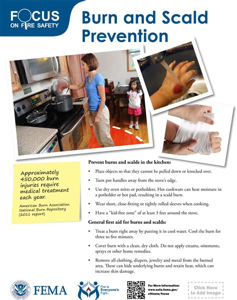 Prevent Burns And Scalds In The Kitchen And Know How To Treat Burns And