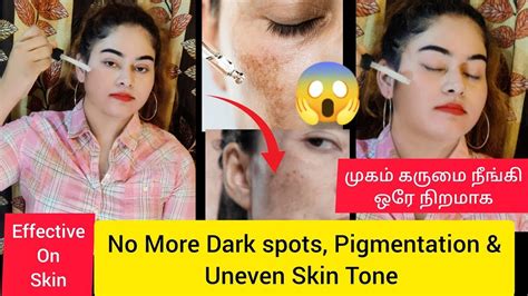 Skin Whitening Serum Effective Dark Spots Pigmentation Removal