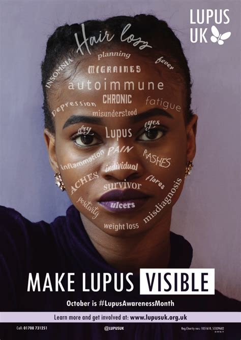 Raise Awareness Lupus Uk