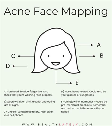 Acne Face Maps The Reasons Behind Your Breakouts