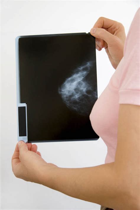 Dr Helene Irvine Says Scotlands Breast Screening Programme Should Be Scrapped Uk News