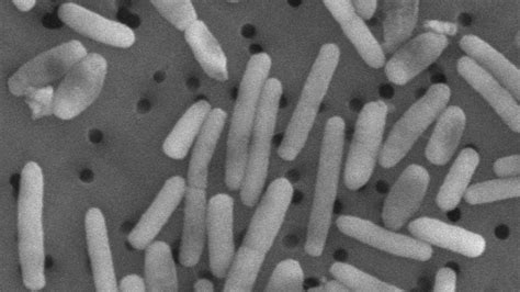 Scientists Just Discovered The Oldest Strain Of Black Death Bacteria In