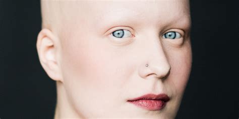 Stunning Portraits Of Women With Alopecia Redefine Femininity Huffpost