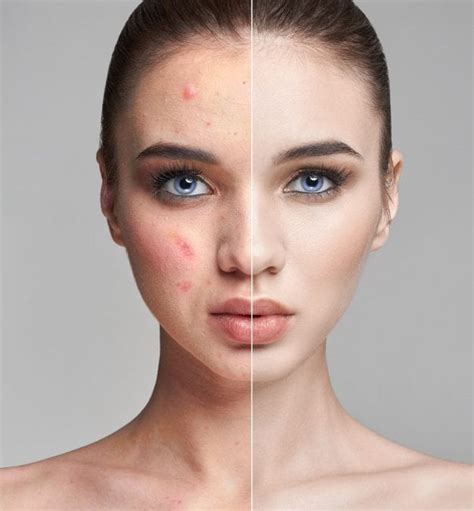How To Deal With A Bad Skin Day Medifine Skin Clinic