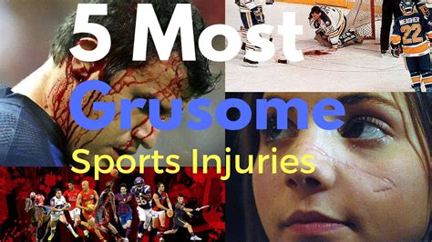 5 Most Gruesome Sports Injuries Youtube