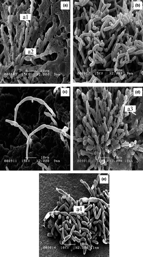 Scanning Electron Micrographs Of Candida Krusei For The Various Growth