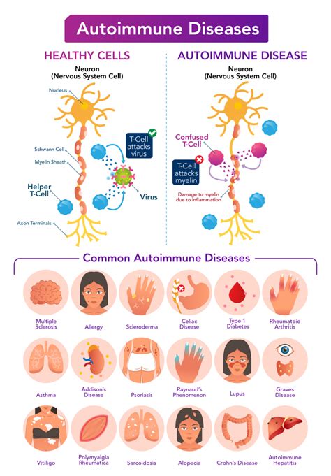 Autoimmune Diseases Pictures