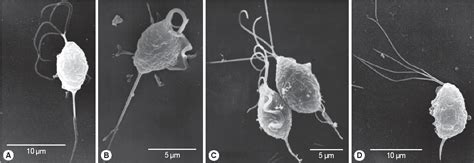 Trichomonas Vaginalis Under Microscope