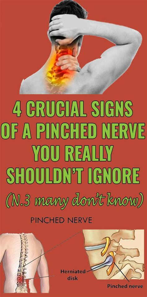 These Are Some Of The More Common Symptoms Of Compressed Nerves