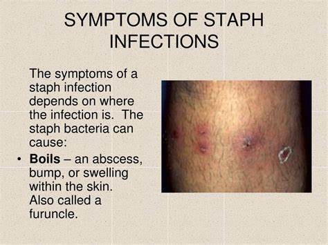 types of staph skin infections