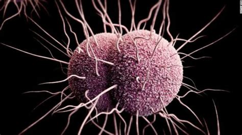 Gonorrhea Drug Resistance This Std Could Get Harder To Treat Cnn