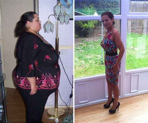 morbidly obese woman rejects gastric band op loses 20st the old fashioned way obese woman