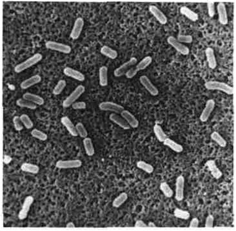 Listeria monocytogenes is a bacterium infectious to humans and causes the illness listeriosis. Listeria - Medical Daily News - Health News | Medical Actu ...