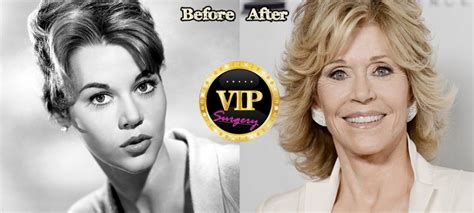 Jane Fonda Plastic Surgery Before And After Photos