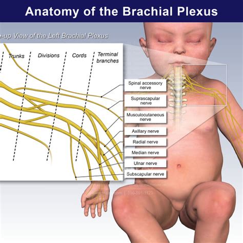 Anatomy And Close Up Of The Left Brachial Plexus Trialexhibits Inc