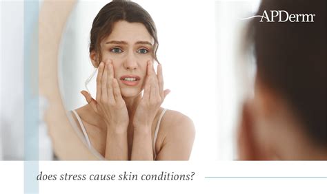 Skin Conditions Caused By Stress And Anxiety Apderm