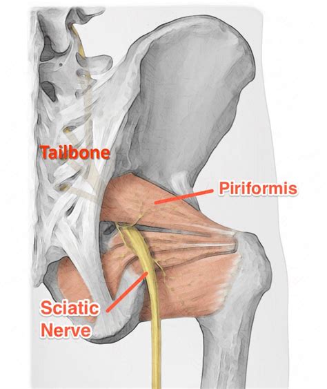 Success Of Pinformis Injection Regenexx Blog