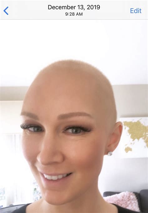 Hair Growth After Chemo Timeline With Pictures Hair Growth After