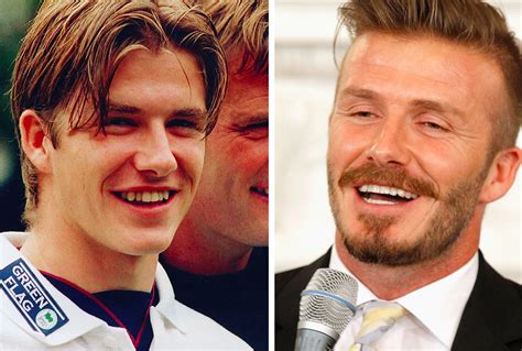 Check Our David Beckhams Celebrity Dentistry Before And After What A