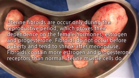 Large Fibroid Uterus Surgery