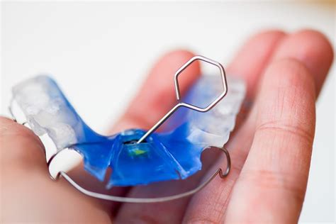 You don't want to waste all that money and time spent on braces only to have it all go back because you didn't wear your retainer. Why You Need to Wear a Retainer After Braces - Dunn ...