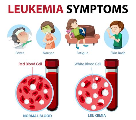 Acute Myeloid Leukemia Enez Health