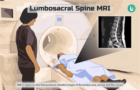 Mri Lumbar Spine Ls Purpose Procedure Scanning Ganesh Hot Sex Picture