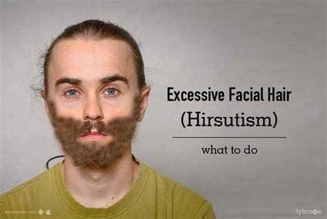 Excessive Facial Hair Hirsutism What To Do By Dr Rohit Batra